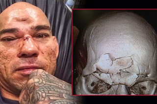 10 Must Know Facts About MMA