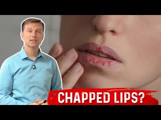 Which Vitamin Deficiency Causes Chapped / Cracked Lips  Dr. Berg