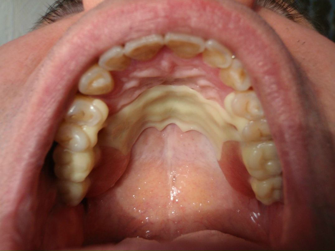 Эрнест Абрамян | Москва