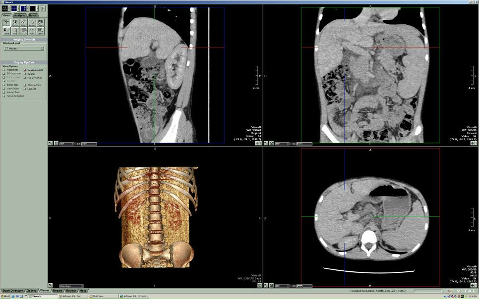 №146, Гео Бекджанян, Москва №146, Гео Бекджанян, Москва