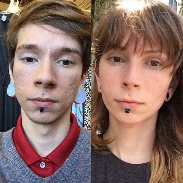 Mtf freckles snapchat drunk