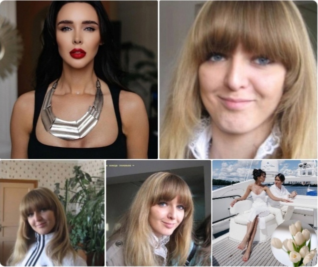 Тимур хайдаров до и после пластики Тимур хайдаров до и после пластики