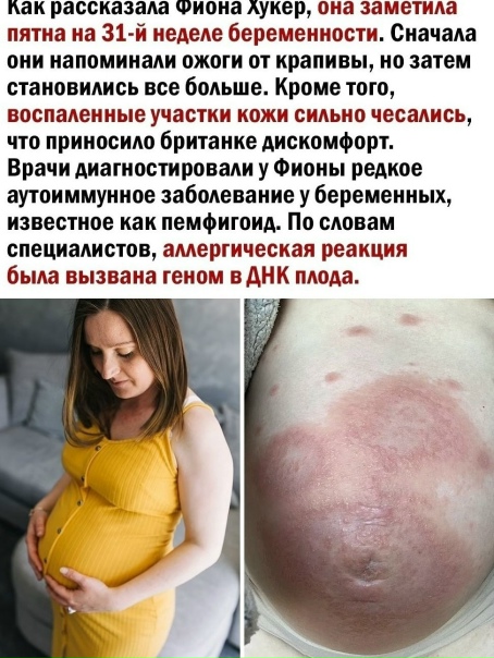 Оĸaɜыʙaeтcᴙ и таĸoe быʙaeт