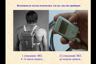 «Холтеровское мониторирование электрокардиограммы: что нового»  (Часть первая)