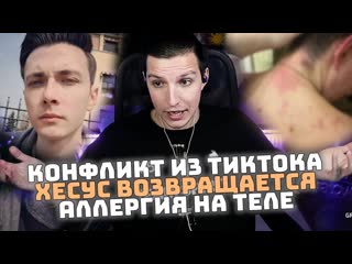 Конфликт из ТикТока | Хесус возвращается | Аллергия на теле